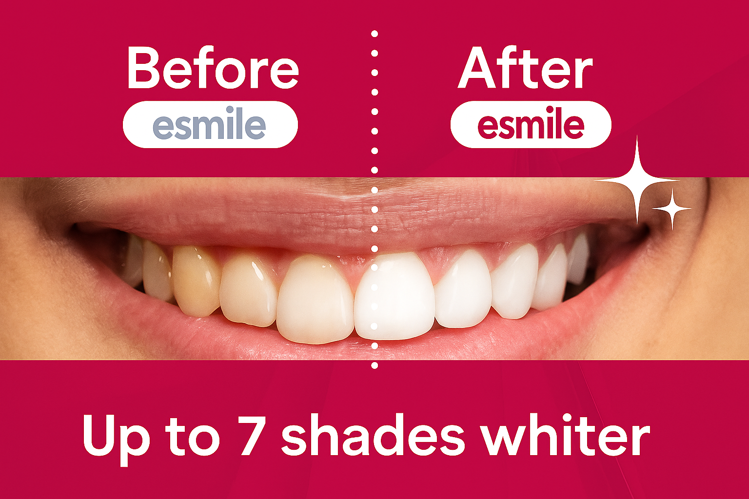 Red velvet-Teeth Whitening Strips – Fast, Safe & Professional At-Home Whitening (14 Strips)