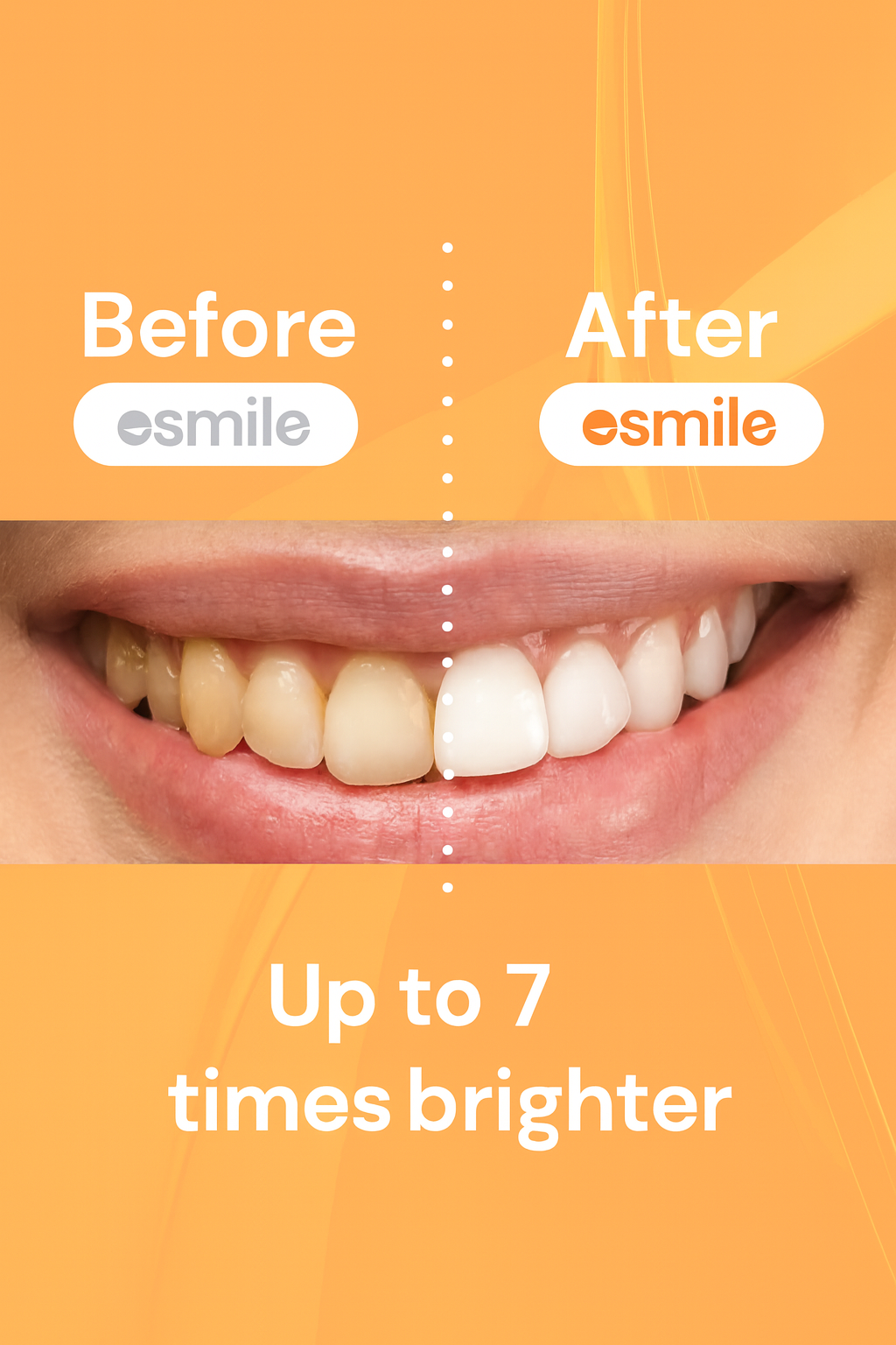 Mango-Teeth Whitening Strips – Fast, Safe & Professional At-Home Whitening (14 Strips)