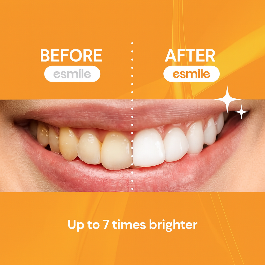 Peach-Teeth Whitening Strips – Fast, Safe & Professional At-Home Whitening (14 Strips)