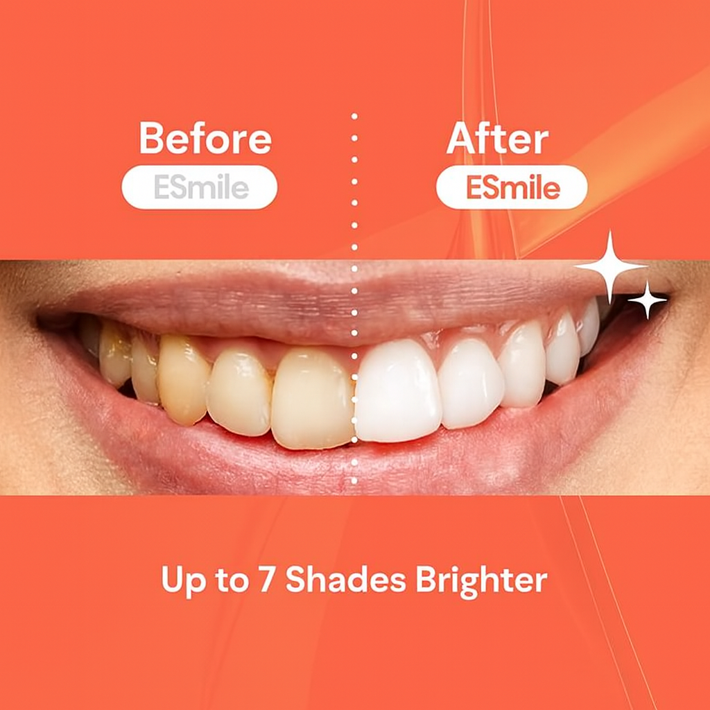 Watermelon-Teeth Whitening Strips – Fast, Safe & Professional At-Home Whitening (14 Strips)